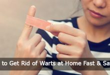 How-to-Get-Rid-of-Warts-at-Home