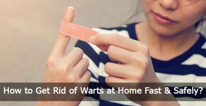 How-to-Get-Rid-of-Warts-at-Home