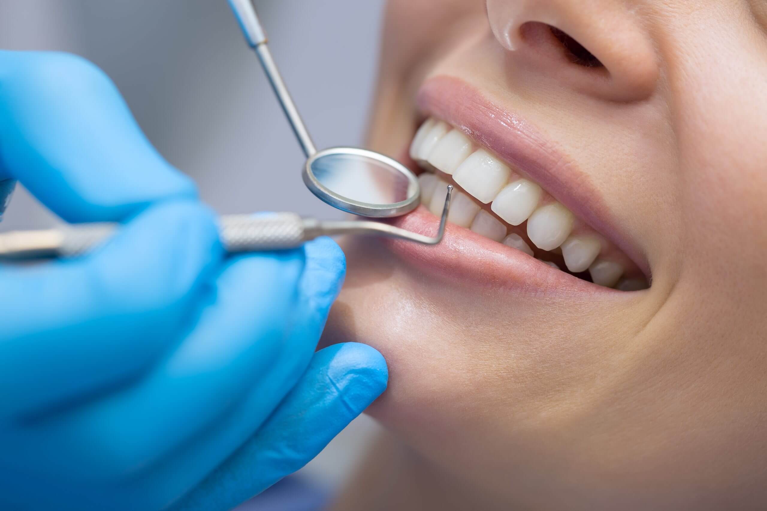 Dental Filling