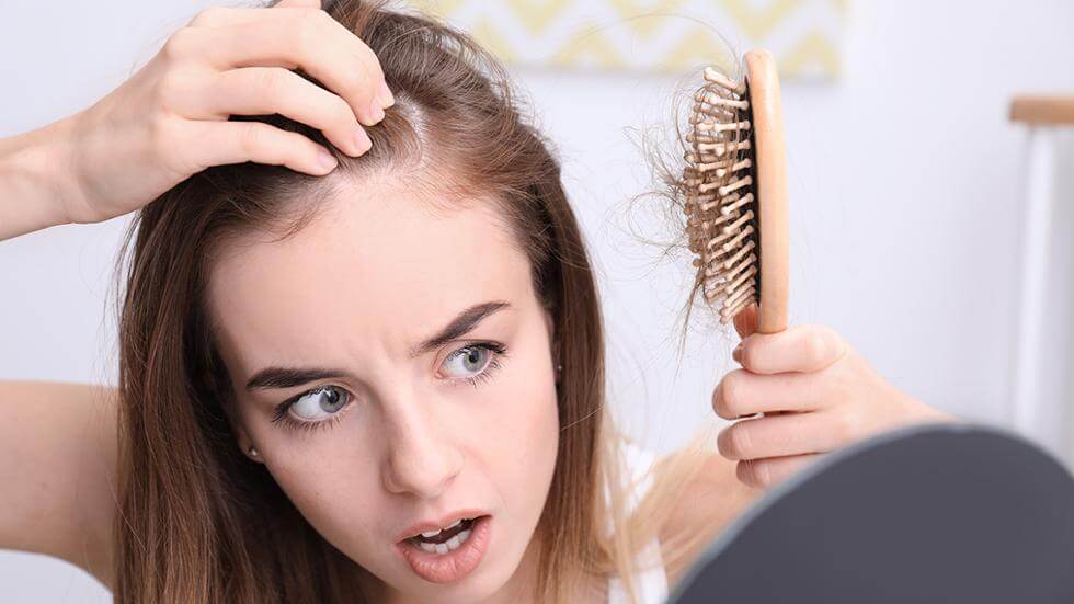 Hair Loss