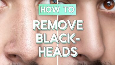 Ways To Remove Blackheads