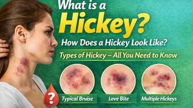 What are Hickeys