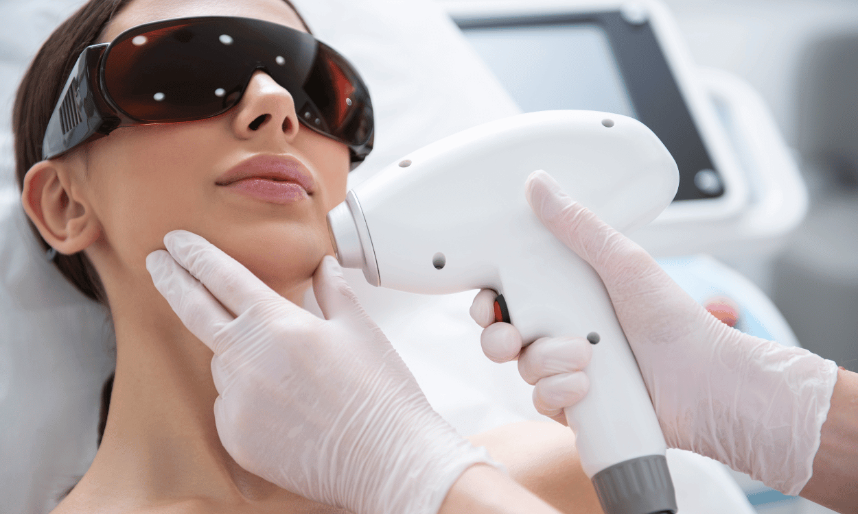 laser facial hair removal