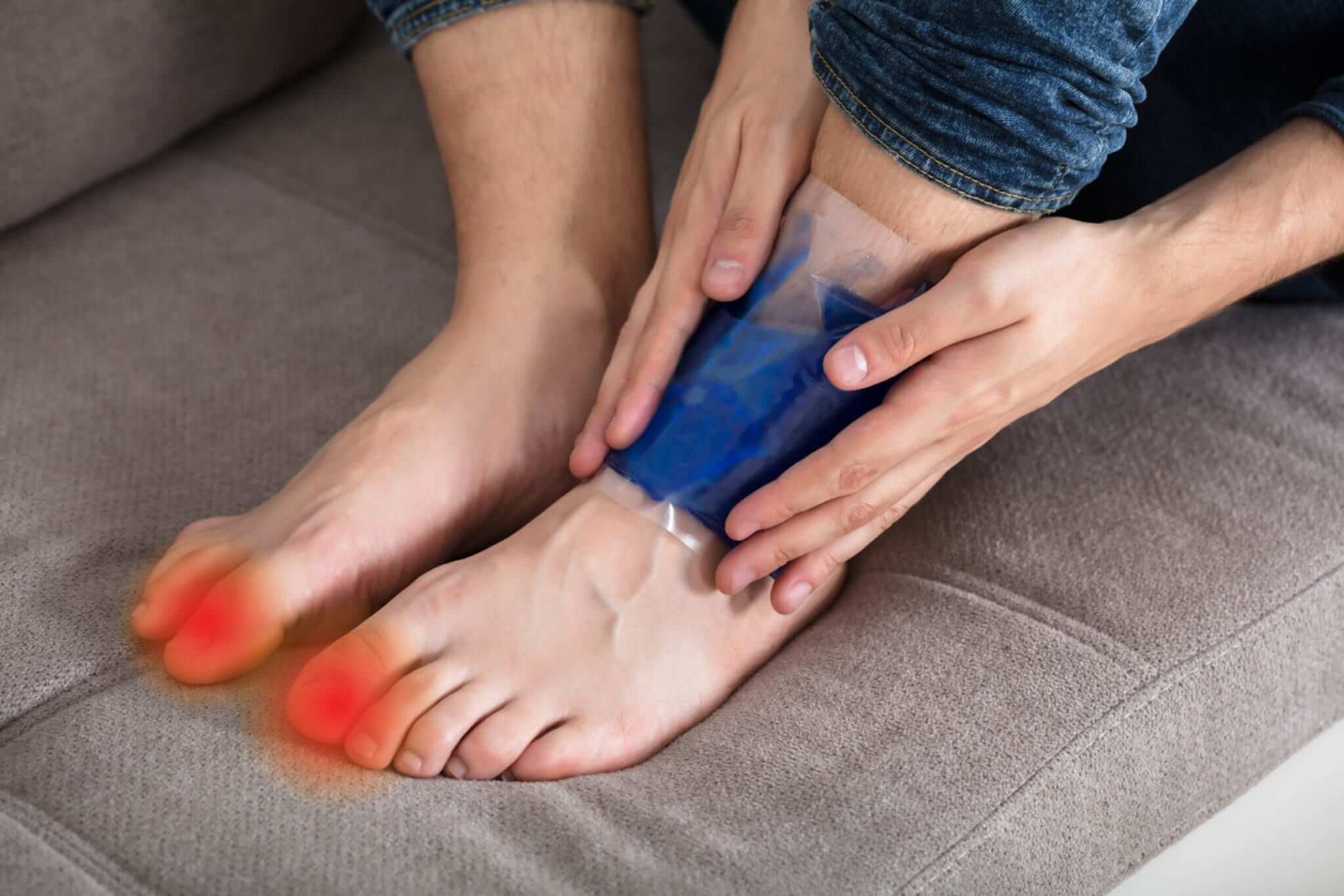 Home Remedies For Gout