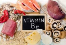 Vitamin B12 Deficiency