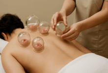 Professional cupping therapy being performed with glass cups on the back