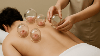 Professional cupping therapy being performed with glass cups on the back