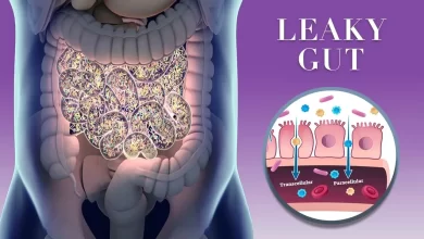 Leaky Gut Syndrome