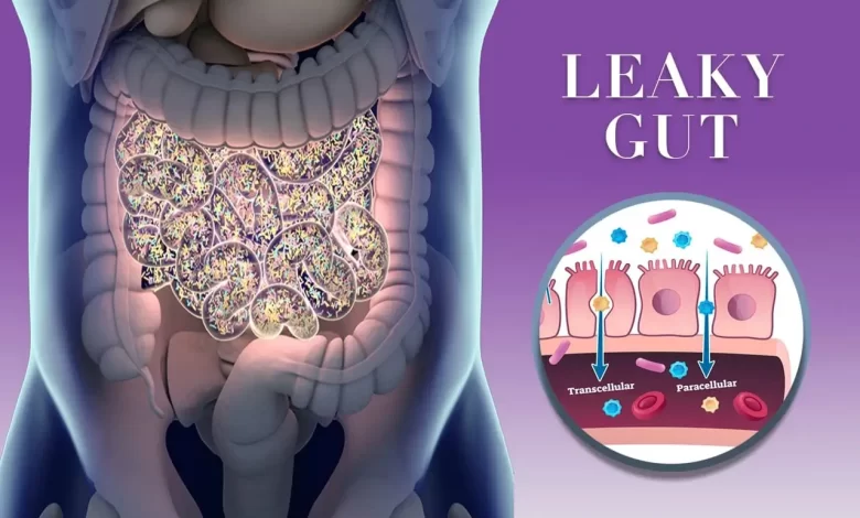 Leaky Gut Syndrome