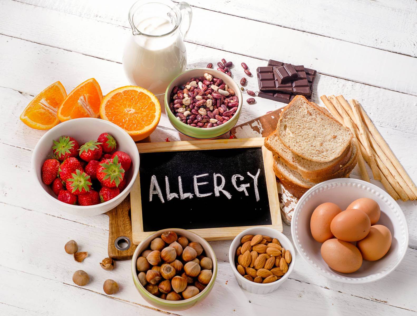 food allergies