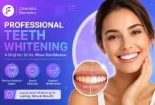 Teeth Whitening Vaughan for a Brighter Smile