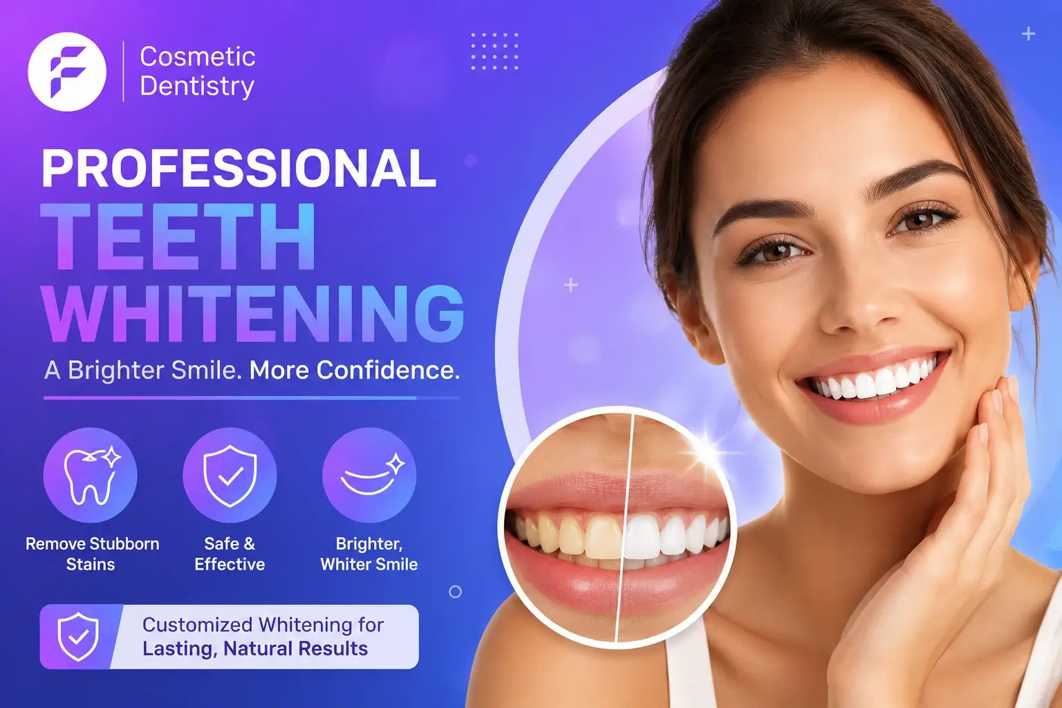 Teeth Whitening Vaughan for a Brighter Smile