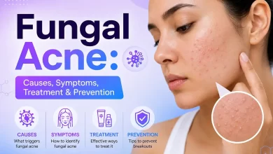 Fungal Acne