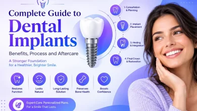 Dental Implants
