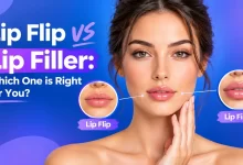Lip Flip vs Lip Filler